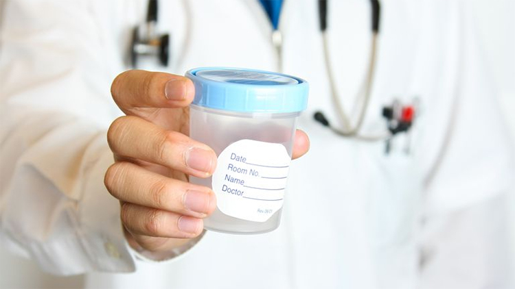 Nam giới nên kiêng không quan hệ tình dục ít nhất 48 tiếng trước khi lấy mẫu tinh dịch