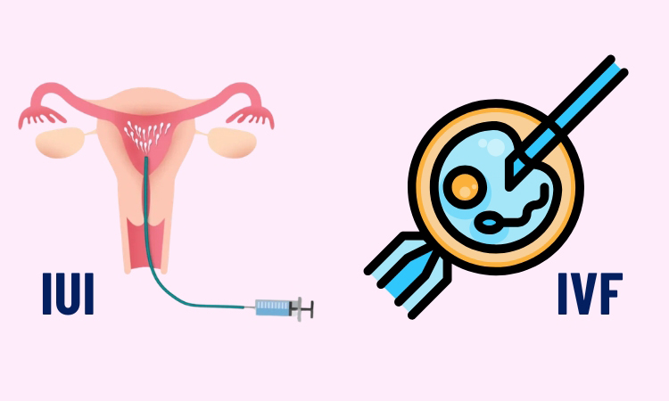 Phụ nữ từ 35 tuổi trở lên nên ưu tiên chọn phương pháp IVF để đạt hiệu quả tốt nhất