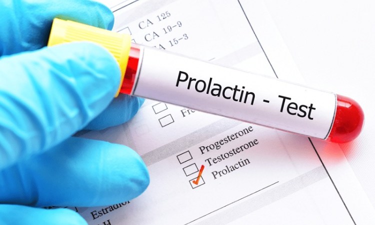 Giá trị prolactin bình thường và ngưỡng tăng có thể khác nhau giữa các phòng xét nghiệm