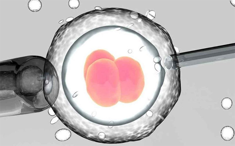 IVF kết hợp PGT có thể xác định giới tính của phôi trước khi chuyển vào tử cung